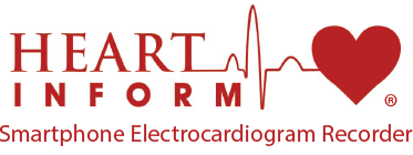 Detección de infarto mortal: inmediata, precisa
